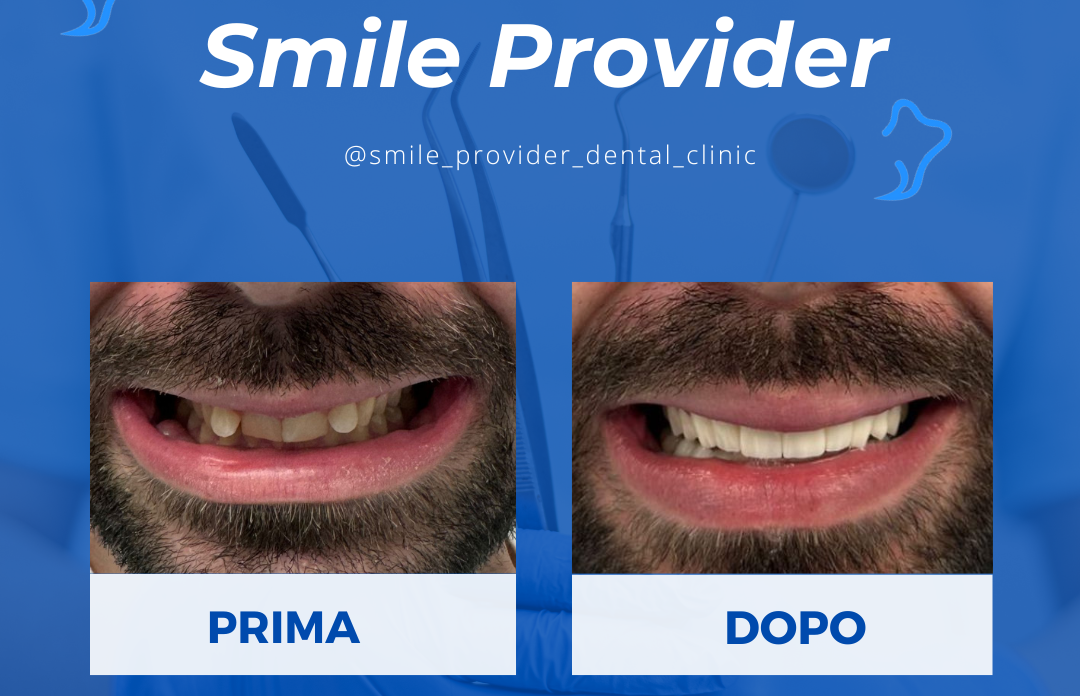 Impianto dentale albania prezzi