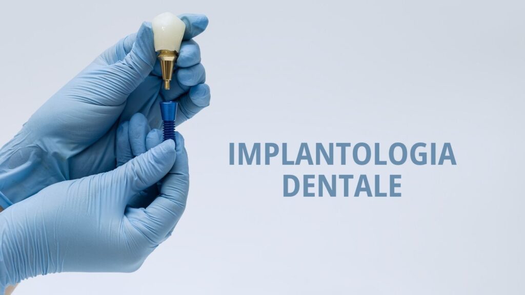 trattamento implantologia